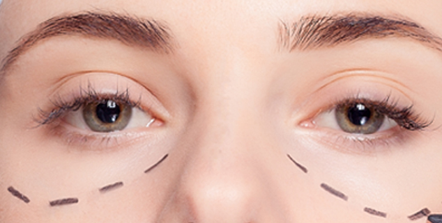 Scarless Under-Eye Fat Removal: How My Mirae Clinic Treats Eye Bags Without Downtime