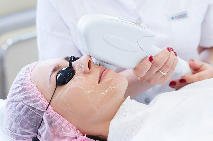 Acne Scars and Texture? Laser Your Way to Clearer Skin